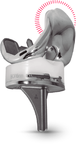 Rodilla Primaria Aikon